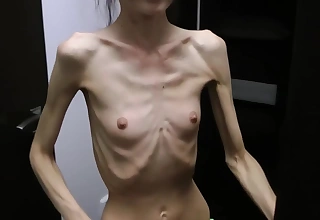 Anorexic Denisa posing increased by has ribs artificial