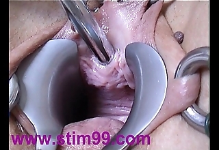 Peehole feigning gender urethral sound insertion distension